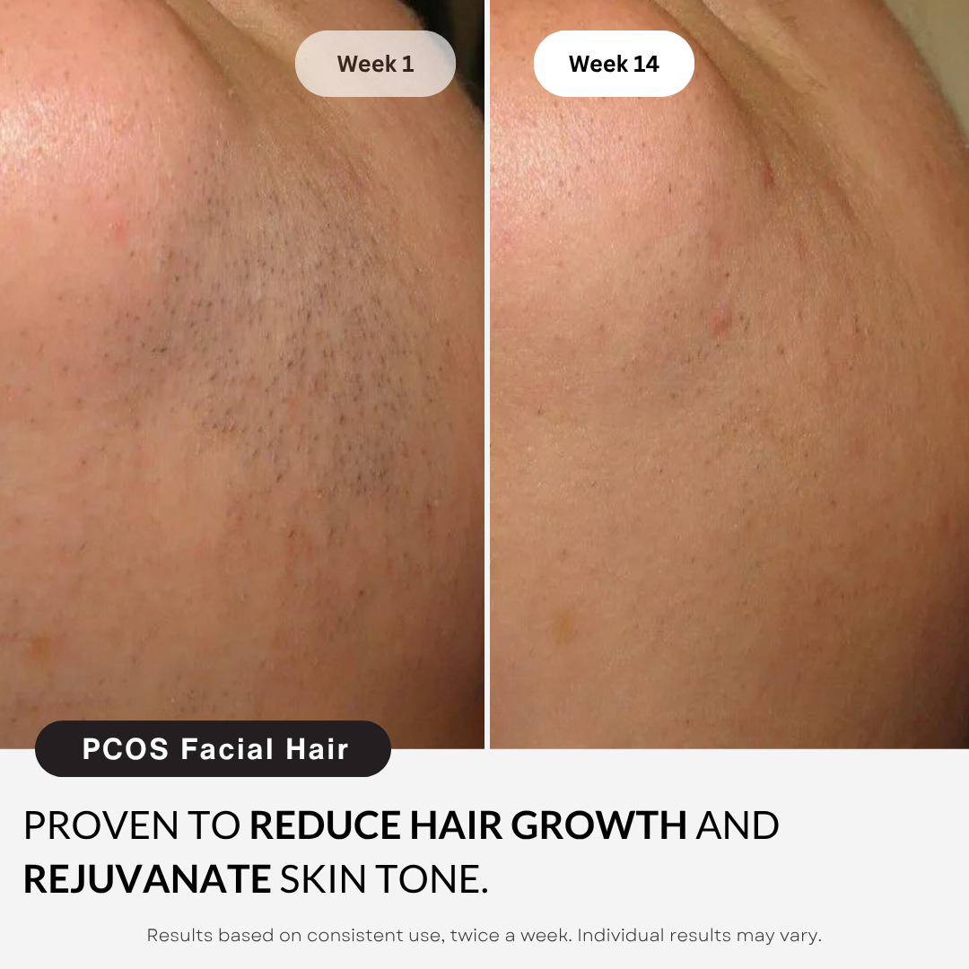 My Smooth Skin Pro™