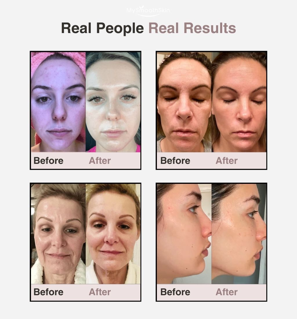Micro-Glow Beautifying & Sculpting Device