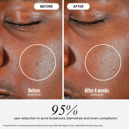 PureGlow Ultralite Silicon LED Face Mask