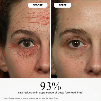 My Smooth Skin LumiPore 5-in-1 Skin Booster
