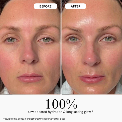 My Smooth Skin LumiPore 5-in-1 Skin Booster