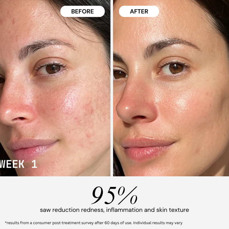 PureGlow Ultralite Silicon LED Face Mask