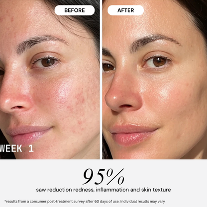 PureGlow Ultralite Silicon LED Face Mask