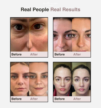 My Smooth Skin EyePods™